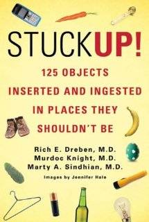 Stuck Up 100 Objects Inserted and Ingested in Places They Shouldnt 