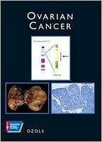 Ovarian Cancer American Cancer Society Atlas of Clinical Oncology 