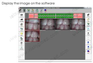   SONY CCD 4 Mega Pixels Dental Intraoral Intra Oral Camera USB  