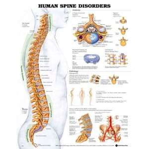 Human Spine Disorders Anatomy 3D Raised Chart/Poster  