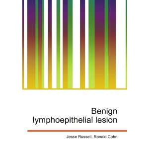  Benign lymphoepithelial lesion Ronald Cohn Jesse Russell 