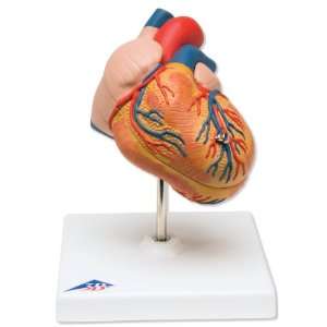   G04 2 Part Classic Heart with Left Ventricular Hypertrophy (LVH) Model