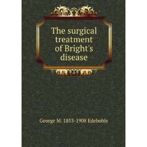  treatment of Brights disease George M. 1853 1908 Edebohls Books
