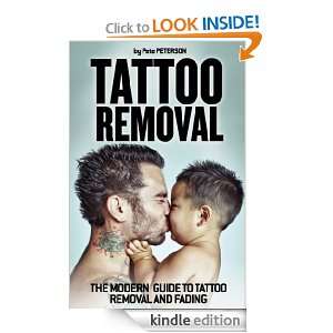   to Tattoo Removal and Fading Pete Peterson  Kindle Store