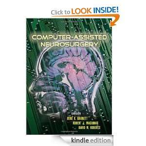 Computer Assisted Neurosurgery Gene H. Barnett, Robert Maciunas 